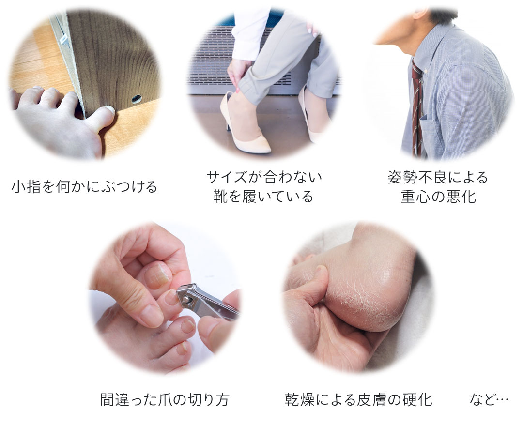 副爪の原因